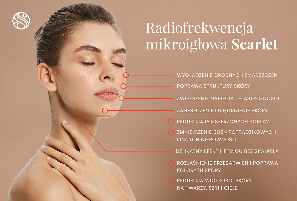 Scarlet RF – Radiofrekwencja mikroigłowa w Łodzi 