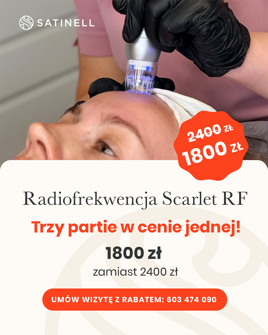 radiofrekfencja-scarlet-rf-wrzesien Radiofrekwencja Scarlet RF
